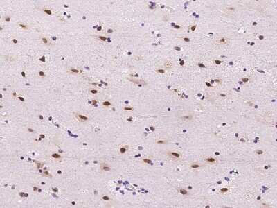 Immunohistochemistry-Paraffin: E2F6 Antibody [NBP2-99087] - Immunochemical staining of human E2F6 in human brain with rabbit polyclonal antibody at 1:300 dilution, formalin-fixed paraffin embedded sections.