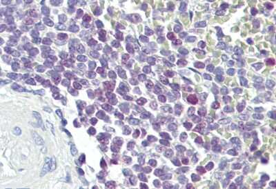 Immunohistochemistry: E74 like factor 1 Antibody [NBP3-10893] - Immunohistochemical analysis of spleen.