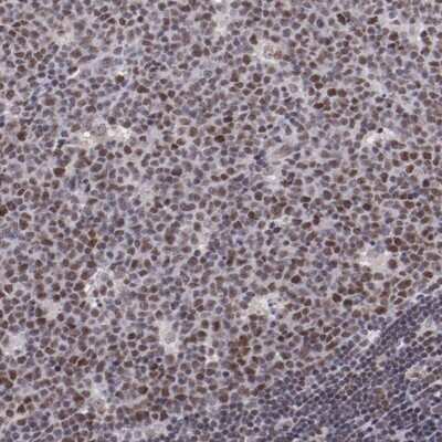 Immunohistochemistry-Paraffin: E74 like factor 1 Antibody [NBP1-90352] - Staining of human lymph node shows distinct nuclear positivity in germinal center cells.