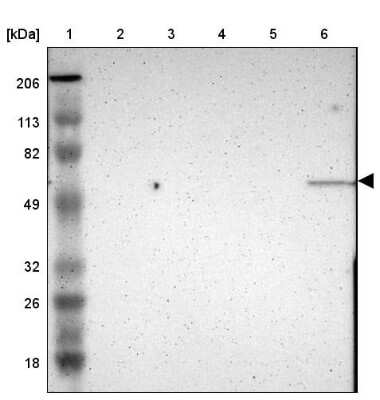 Western Blot: E74 like factor 1 Antibody [NBP1-90352] - Lane 1: Marker  [kDa] 206, 113, 82, 49, 32, 26, 18.   Lane 2: Human cell line RT-4.  Lane 3: Human cell line U-251MG sp.  Lane 4: Human cell line A-431.  Lane 5: Human liver tissue.  Lane 6: Human tonsil tissue