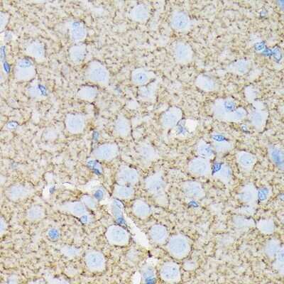 Immunohistochemistry-Paraffin: EAAT1/GLAST-1/SLC1A3 Antibody (7Y4U5) [NBP3-16865] - Rat brain using EAAT1/GLAST-1/SLC1A3 Rabbit mAb (NBP3-16865) at dilution of 1:100 (40x lens).Perform microwave antigen retrieval with 10 mM Tris/EDTA buffer pH 9.0 before commencing with IHC staining protocol.