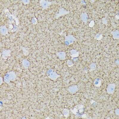 Immunohistochemistry-Paraffin: EAAT1/GLAST-1/SLC1A3 Antibody (7Y4U5) [NBP3-16865] - Human brain using EAAT1/GLAST-1/SLC1A3 Rabbit mAb (NBP3-16865) at dilution of 1:100 (40x lens).Perform microwave antigen retrieval with 10 mM Tris/EDTA buffer pH 9.0 before commencing with IHC staining protocol.