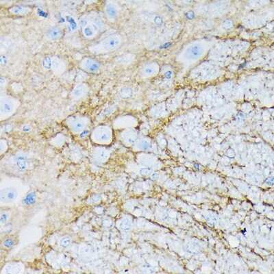 Immunohistochemistry-Paraffin: EAAT1/GLAST-1/SLC1A3 Antibody (7Y4U5) [NBP3-16865] - Mouse spinal cord using EAAT1/GLAST-1/SLC1A3 Rabbit mAb (NBP3-16865) at dilution of 1:100 (40x lens).Perform microwave antigen retrieval with 10 mM Tris/EDTA buffer pH 9.0 before commencing with IHC staining protocol.