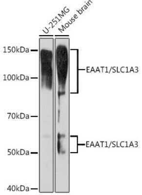 Western Blot: EAAT1/GLAST-1/SLC1A3 Antibody (7Y4U5) [NBP3-16865] - Analysis of extracts of various cell lines, using EAAT1/GLAST-1/SLC1A3 Rabbit mAb (NBP3-16865) at 1:1000 dilution. Secondary antibody: HRP Goat Anti-Rabbit IgG (H+L) at 1:10000 dilution. Lysates/proteins: 25ug per lane. Blocking buffer: 3% nonfat dry milk in TBST. Detection: ECL Enhanced Kit. Exposure time: 3min.