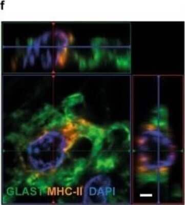 Immunocytochemistry/Immunofluorescence: EAAT1/GLAST-1/SLC1A3 Antibody [NB100-1869] - Human astrocytes express MHC-II in brain tissue from PD patients and healthy controls. The aSYN pathology was confirmed in the PD cases by immunostaining of aSYN and phosphorylated aSYN (p-aSYN). Astrocytes labeled with EAAT1/GLAST-1/SLC1A3 are expressing high levels of MHC-II, as well as Iba1-labeled microglia. Image collected and cropped by CiteAb from the following publication (//jneuroinflammation.biomedcentral.com/articles/10.1186/s12974-020-01776-7), licensed under a CC-BY license.