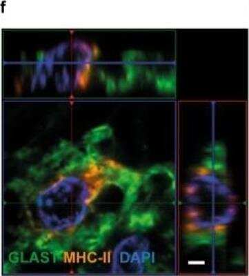 Immunocytochemistry/Immunofluorescence: EAAT1/GLAST-1/SLC1A3 Antibody [NB100-1869] - Human astrocytes express MHC-II in brain tissue from PD patients and healthy controls. The aSYN pathology was confirmed in the PD cases by immunostaining of aSYN and phosphorylated aSYN (p-aSYN). Astrocytes labeled with EAAT1/GLAST-1/SLC1A3 are expressing high levels of MHC-II, as well as Iba1-labeled microglia. Image collected and cropped by CiteAb from the following publication (//jneuroinflammation.biomedcentral.com/articles/10.1186/s12974-020-01776-7), licensed under a CC-BY license.