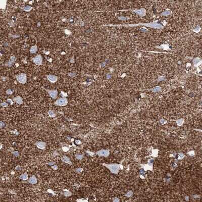 Immunohistochemistry-Paraffin: EAAT1/GLAST-1/SLC1A3 Antibody [NBP1-84939] - Staining of human cerebral cortex shows strong cytoplasmic positivity in neuropil.