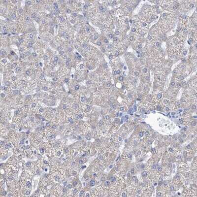 Immunohistochemistry-Paraffin: EAAT1/GLAST-1/SLC1A3 Antibody [NBP1-84939] - Staining of human liver shows very weak positivity in hepatocytes.