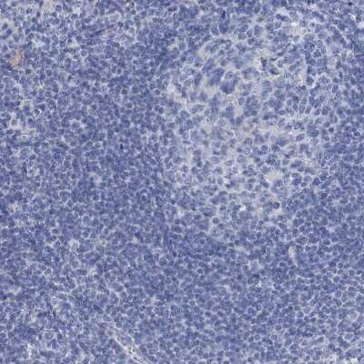 Immunohistochemistry-Paraffin: EAAT1/GLAST-1/SLC1A3 Antibody [NBP1-84939] - Staining of human lymph node shows no positivity in non-germinal center cells.