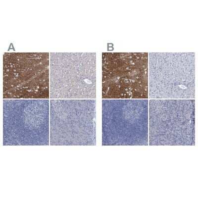 <b>Independent Antibodies Validation. </b>Immunohistochemistry-Paraffin: EAAT1/GLAST-1/SLC1A3 Antibody [NBP1-84939] - Staining of human cerebral cortex, liver, lymph node and pancreas using Anti-SLC1A3 antibody (A) NBP1-84939 shows similar protein distribution across tissues to independent antibody NBP1-84940 (B).