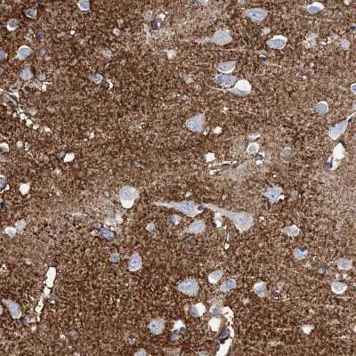 Immunohistochemistry-Paraffin: EAAT1/GLAST-1/SLC1A3 Antibody [NBP1-84940] - Staining of human cerebral cortex shows strong cytoplasmic positivity in neuropil.