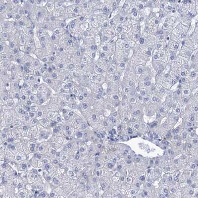 Immunohistochemistry-Paraffin: EAAT1/GLAST-1/SLC1A3 Antibody [NBP1-84940] - Staining of human liver shows no positivity in hepatocytes.