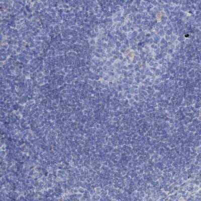 Immunohistochemistry-Paraffin: EAAT1/GLAST-1/SLC1A3 Antibody [NBP1-84940] - Staining of human lymph node shows no positivity in non-germinal center cells.