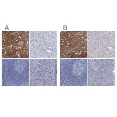 <b>Independent Antibodies Validation and Orthogonal Strategies Validation.</b>Immunohistochemistry-Paraffin: EAAT1/GLAST-1/SLC1A3 Antibody [NBP1-84940] - Staining of human cerebral cortex, kidney, skeletal muscle and thyroid gland using Anti-PDIA3 antibody (A) NBP1-84940 shows similar protein distribution across tissues to independent antibody NBP1-84939 (B).