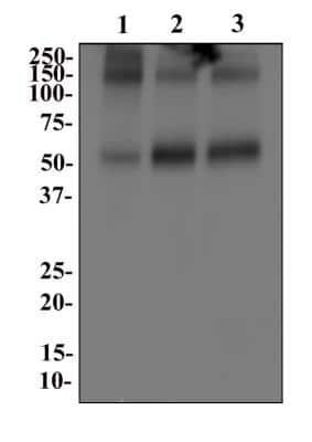 Western Blot: EAAT1/GLAST-1/SLC1A3 Antibody [NB100-1869] - Analysis of SLC1A3 in 1. Human brain 2. Mouse brain and 3. Rat brain whole cell lysates.