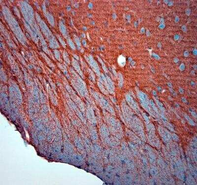 Immunohistochemistry-Paraffin: EAAT2/GLT1 Antibody - Azide Free [NBP1-20136] - Mouse brain (hippocampus). The animal was perfused at a pressure of 130 mmHg with 300 ml 4% FA before being processed for paraffin embedding. HIER: Tris-EDTA, pH 9 for 20 min.