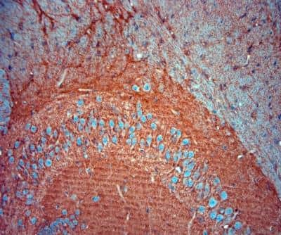 Immunohistochemistry-Paraffin: EAAT2/GLT1 Antibody - Azide Free [NBP1-20136] - Mouse brain (hippocampus). The animal was perfused using Autoperfuser at a pressure of 130 mmHg with 300 ml 4% FA before being processed for paraffin embedding. HIER: Tris-EDTA, pH 9 for 20 min. Blocking: 0.2% LFDM in TBST filtered thru 0.2 um.