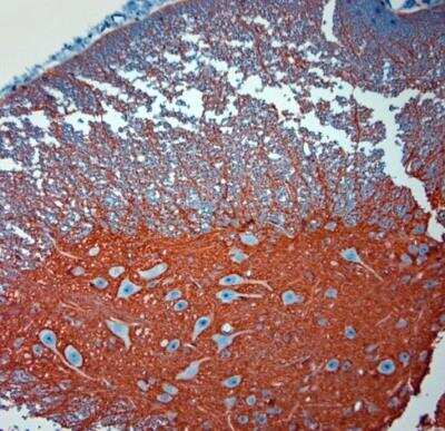 Immunohistochemistry-Paraffin: EAAT2/GLT1 Antibody - Azide Free [NBP1-20136] - Sections of mouse spinal cord. The animal was perfused using Autoperfuser at a pressure of 130 mmHg with 300 ml 4% FA before being processed for paraffin embedding. HIER: Tris-EDTA, pH 9 for 20 min. Blocking: 0.2% LFDM in TBST filtered thru 0.2 um.