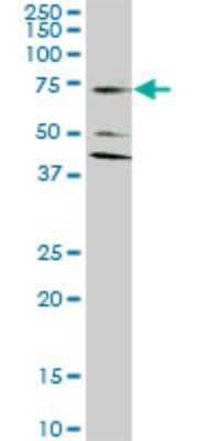 Western Blot: EAAT2/GLT1 Antibody (1D8) [H00006506-M07] - Analysis of SLC1A2 expression in HeLa (Cat # L013V1).