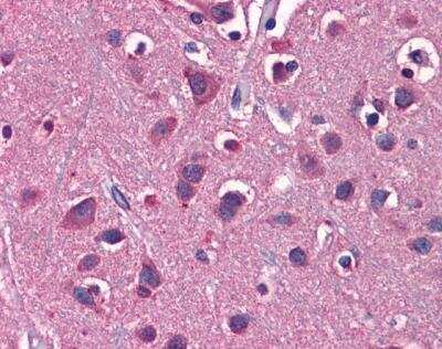 Immunohistochemistry-Paraffin: EAAT2/GLT1 Antibody [NBP1-59632] - Human Brain, cortex tissue at an antibody concentration of 5 ug/ml.