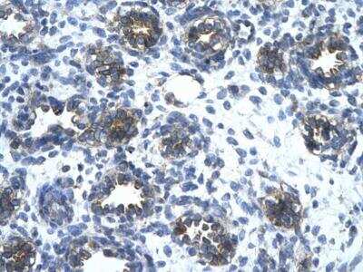 Immunohistochemistry-Paraffin: EAAT2/GLT1 Antibody [NBP1-59632] - Human alveolar cell.