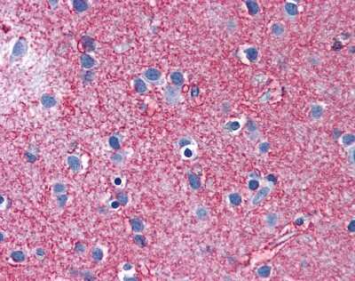 Immunohistochemistry-Paraffin: EAAT2/GLT1 Antibody [NBP1-59633] - Human Brain, cortex tissue at an antibody concentration of 5 ug/ml.