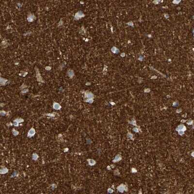 Immunohistochemistry-Paraffin: EAAT2/GLT1 Antibody [NBP1-84027] - Staining of human cerebral cortex shows high expression.