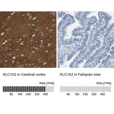 Immunohistochemistry-Paraffin: EAAT2/GLT1 Antibody [NBP1-84027] - Analysis in human cerebral cortex and fallopian tube tissues using NBP1-84027 antibody. Corresponding EAAT2/GLT1 RNA-seq data are presented for the same tissues.