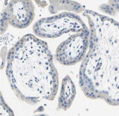 Immunohistochemistry-Paraffin: EAAT2/GLT1 Antibody [NBP1-84027] - Staining of human placenta shows no positivity in trophoblastic cells as expected.