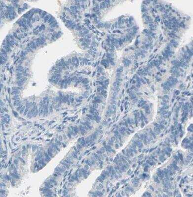 Immunohistochemistry-Paraffin: EAAT2/GLT1 Antibody [NBP1-84027] - Staining of human placenta shows no positivity in trophoblastic cells as expected.