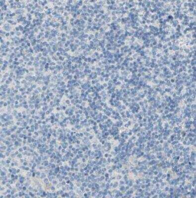 <b>Orthogonal Strategies Validation. </b>Immunohistochemistry-Paraffin: EAAT2/GLT1 Antibody [NBP1-84027] - Staining of human lymph node shows no positivity in non-germinal center cells as expected.