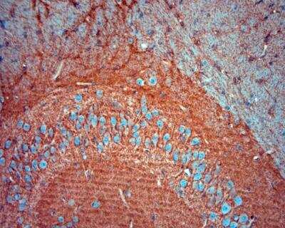 Immunohistochemistry-Paraffin: EAAT2/GLT1 Antibody [NBP2-68147] - Sections of mouse brain (hippocampus). Dilution 1: 1000. 