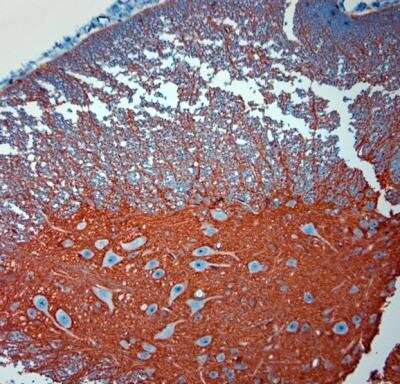 Immunohistochemistry-Paraffin: EAAT2/GLT1 Antibody [NBP2-68147] - Sections of mouse spinal cord. Dilution 1:1000