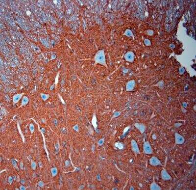 Immunohistochemistry-Paraffin: EAAT2/GLT1 Antibody [NBP2-68147] - Sections of mouse spinal cord. Dilution 1:1000.