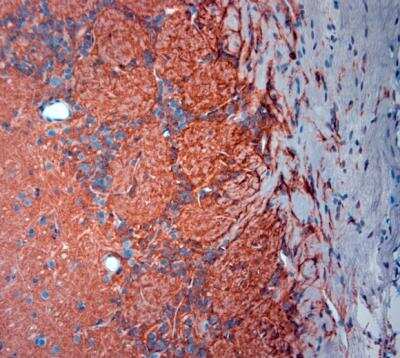 Immunohistochemistry-Paraffin: EAAT2/GLT1 Antibody [NBP2-68147] - Sections of mouse olfactory bulbs. Dilution 1:1000.