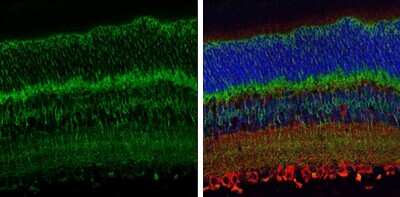 Immunohistochemistry-Paraffin: EAAT2/GLT1 Antibody [NBP3-13348] - EAAT2/GLT1 antibody detects EAAT2/GLT1 protein at cell membrane by immunohistochemical analysis. Sample: Paraffin-embedded mouse eye. Green: EAAT2/GLT1 stained by EAAT2/GLT1 antibody (NBP3-13348) diluted at 1:250. Red: beta Tubulin 3/ Tuj1, a cytoplasm marker, stained by beta Tubulin 3/ Tuj1 antibody [GT1338] (NBP3-13505) diluted at 1:500. Blue: Fluoroshield with DAPI. Antigen Retrieval: Citrate buffer, pH 6.0, 15 min