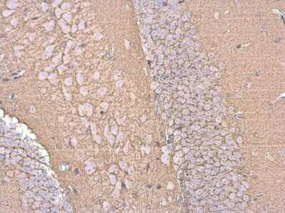 Immunohistochemistry-Paraffin: EAAT2/GLT1 Antibody [NBP3-13348] - EAAT2/GLT1 antibody detects EAAT2/GLT1 protein at cell membrane by immunohistochemical analysis. Sample: Paraffin-embedded mouse hippocampus. EAAT2/GLT1 stained by EAAT2/GLT1 antibody (NBP3-13348) diluted at 1:500. Antigen Retrieval: Citrate buffer, pH 6.0, 15 min