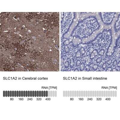 Immunohistochemistry-Paraffin: EAAT2/GLT1 Antibody [NBP3-17032] - Analysis in human cerebral cortex and small intestine tissues using Anti-SLC1A2 antibody. Corresponding SLC1A2 RNA-seq data are presented for the same tissues.