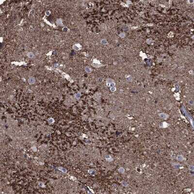 Immunohistochemistry-Paraffin: EAAT2/GLT1 Antibody [NBP3-17032] - Staining of human cerebral cortex shows high expression.