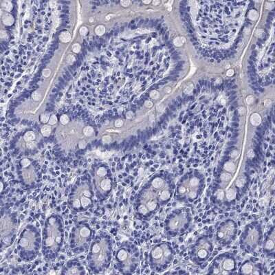 Immunohistochemistry-Paraffin: EAAT2/GLT1 Antibody [NBP3-17032] - Staining of human small intestine shows low expression as expected.