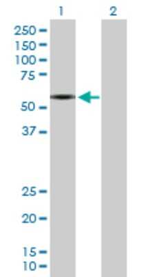 Western Blot: EAAT2/GLT1 Antibody [H00006506-D01P] - Analysis of SLC1A2 expression in transfected 293T cell line by SLC1A2 polyclonal antibody.Lane 1: SLC1A2 transfected lysate(62.10 KDa).Lane 2: Non-transfected lysate.