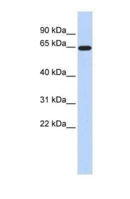 Western Blot: EAAT2/GLT1 Antibody [NBP1-59632] - Titration: 0.2-1 ug/ml, Positive Control: Human brain.