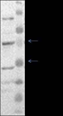 Western Blot: EAAT2/GLT1 Antibody [NBP1-59632] - WB analysis of GLT1 in Hep3B WCL. Image courtesy of anonymous customer product review.