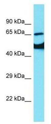 Western Blot: EAAT2/GLT1 Antibody [NBP1-59632] - Human Fetal Brain lysates.