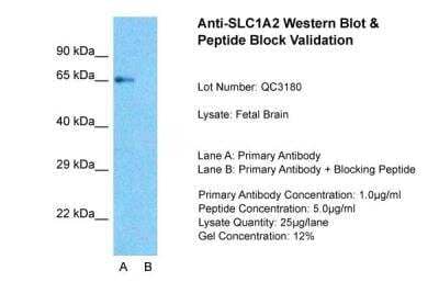 Western Blot: EAAT2/GLT1 Antibody [NBP1-59632] - Fetal Brain Lane A: Primary Antibody  Lane B:Primary Antibody + Blocking Peptide  Primary Antibody Concentration:1ug/ml  Peptide Concentration: 5ug/ml Lysate Quantity: 25ug/lane/Lane Gel Concentration: 0.12