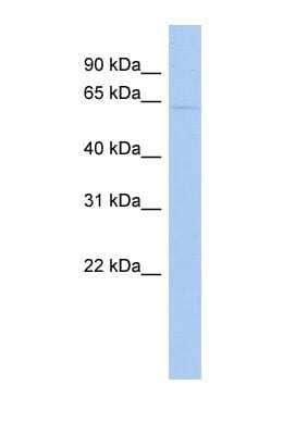 Western Blot: EAAT2/GLT1 Antibody [NBP1-59633] - HT1080 cell lysate, Antibody Titration: 0.2-1 ug/ml