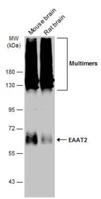 Western Blot: EAAT2/GLT1 Antibody [NBP3-13348] - Various tissue extracts (50 ug) were separated by 7.5% SDS-PAGE, and the membrane was blotted with EAAT2/GLT1 antibody (NBP3-13348) diluted at 1:1000. The HRP-conjugated anti-rabbit IgG antibody (NBP2-19301) was used to detect the primary antibody.