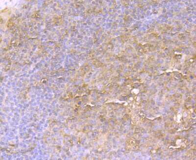 Immunohistochemistry-Paraffin: EAAT3 Antibody (JU39-69) [NBP2-75476] - Analysis of paraffin-embedded human tonsil tissue using anti-EAAT3 antibody. Counter stained with hematoxylin.