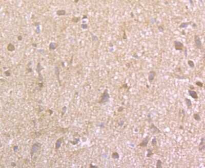 Immunohistochemistry-Paraffin: EAAT3 Antibody (JU39-69) [NBP2-75476] - Analysis of paraffin-embedded rat brain tissue using anti-EAAT3 antibody. Counter stained with hematoxylin.