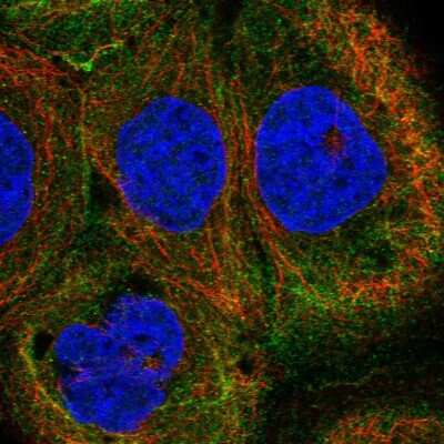 <b>Orthogonal Strategies Validation. </b>Immunocytochemistry/Immunofluorescence: EAAT4 Antibody [NBP2-48740] - Staining of human cell line A-431 shows localization to intermediate filaments.